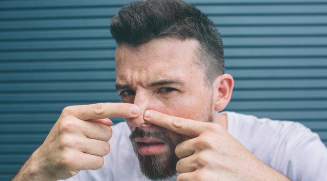 Cara Mengatasi Jerawat di Hidung agar Tidak Kembali Lagi, Begini Triknya